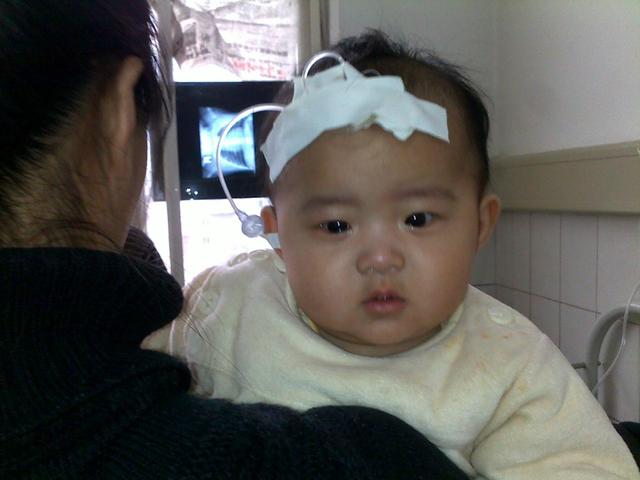 儿童积食需要补硒吗(儿童补硒吃什么药)-硒宝网