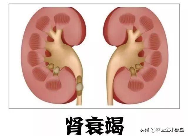 经常运动需要补钙吗(补钙运动需要注意什么)-硒宝网