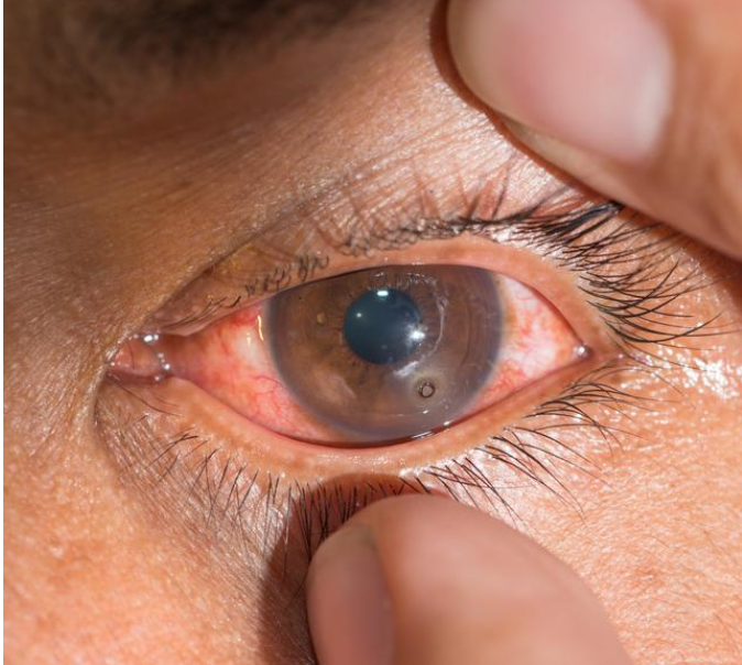 补硒会使血脂升高吗(补硒可以降血脂吗)-硒宝网