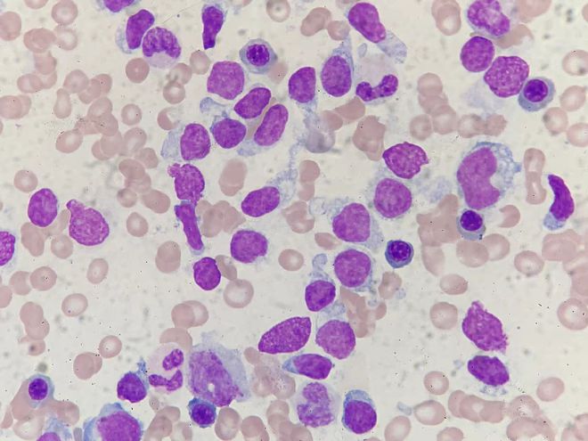 补硒为什么头发变黑(补头发变黑硒片有用吗)-硒宝网