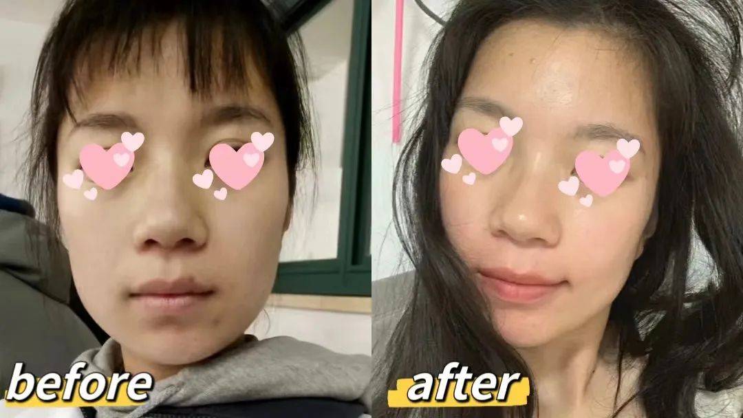 补铁口服液十大排名（补铁口服液排行榜）-硒宝网