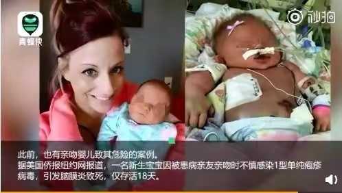 单纯疱疹补硒酵母片(单纯疱疹补硒酵母片)-硒宝网