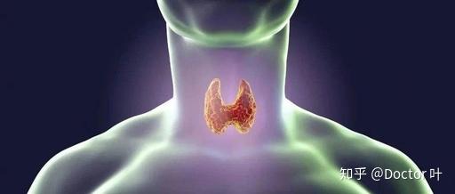 甲状腺结节3类补硒(甲状腺结节补硒有什好处)-硒宝网
