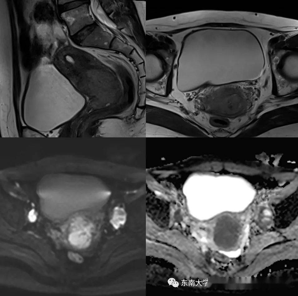 活检病变补硒的目的(活检病变补硒的目的)-硒宝网
