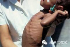 宝宝补钙多了有什么坏处(坏处补钙宝宝有什么危害)-硒宝网