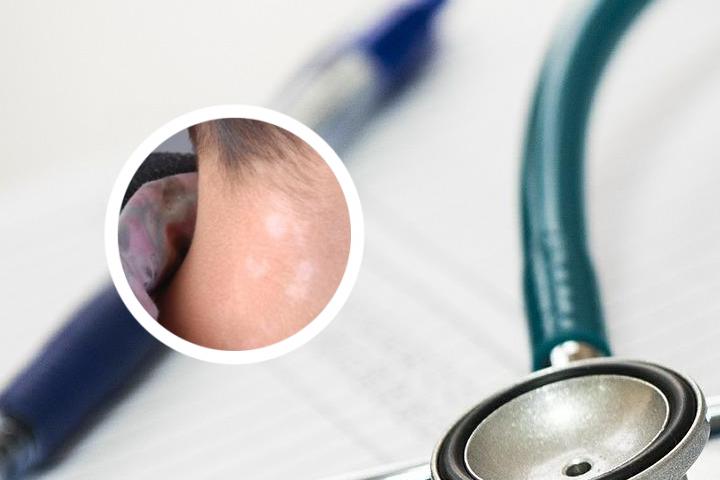 白癜风为什么要补硒（补硒能治疗乙肝吗）-硒宝网