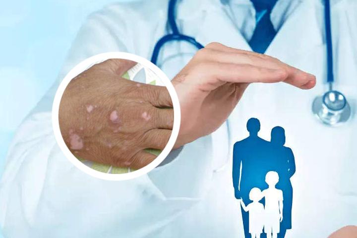 白癜风为什么要补硒（补硒能治疗乙肝吗）-硒宝网