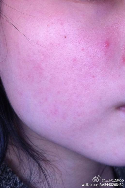 补硒会使头发发黄吗（发黄补头发使硒会变黑吗）-硒宝网