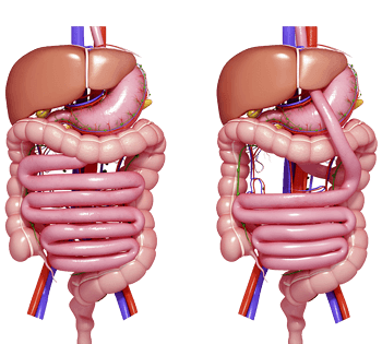 血微量元素是检查什么(微量元素血液检查)-硒宝网