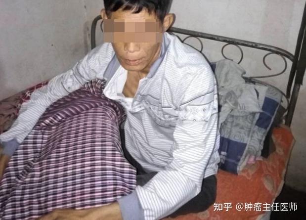 肺癌的人可以补硒吗（肺癌补硒人可以吃海参吗）-硒宝网