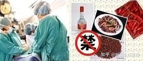 肺癌的人可以补硒吗（肺癌补硒人可以吃海参吗）-硒宝网