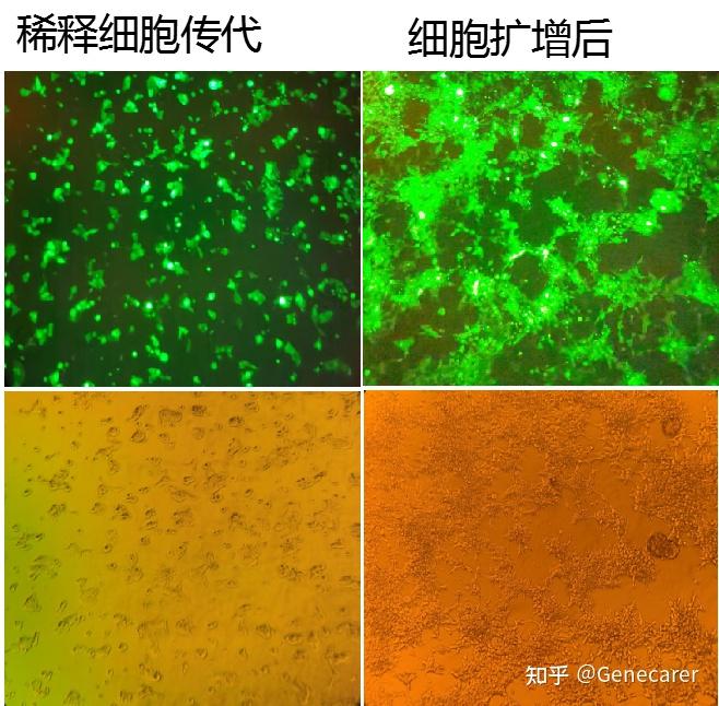 补硒能杀死肿瘤细胞（肿瘤患者补硒有用吗）-硒宝网