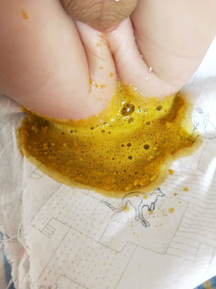 新生儿多久可以补钙(新生儿补钙可以放奶粉里吗)-硒宝网