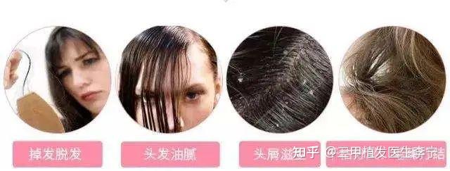 掉头发缺什么微量元素（缺微量掉头发元素是什么）-硒宝网