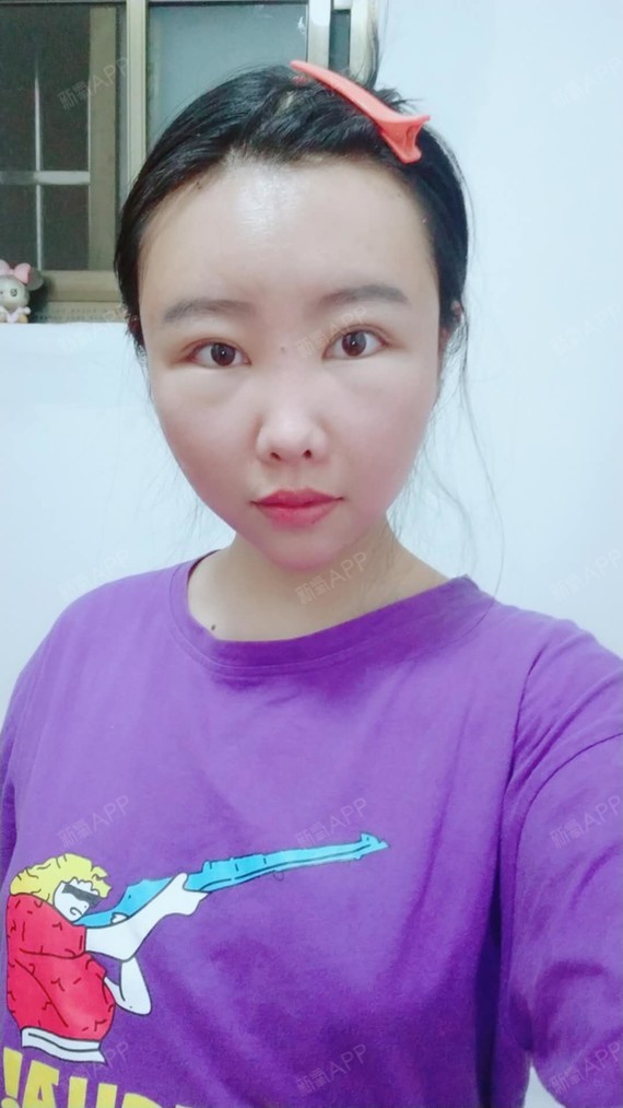 近视缺乏什么微量元素（近视微量元素缺乏）-硒宝网