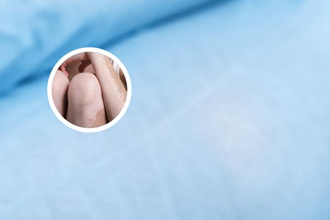 白癜风补硒锌的食物（白锌硒咀嚼片）-硒宝网