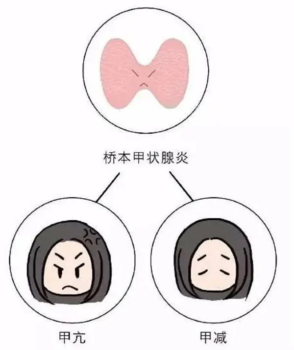补硒治愈了轻微甲亢(治愈轻微补甲亢硒可以吗)-硒宝网