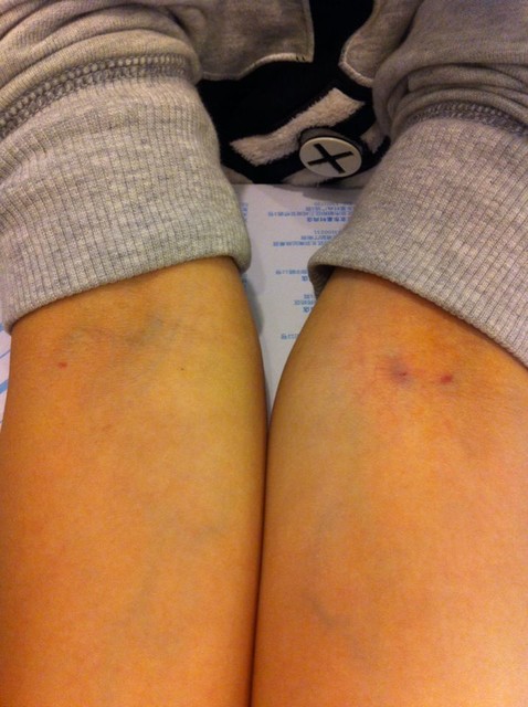 宝宝查微量元素挂什么科（宝宝查微量元素挂儿?？坡穑?硒宝网