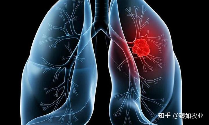 得了癌症可以补硒吗（癌症病人补充硒）-硒宝网