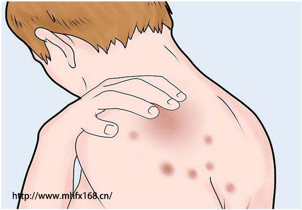 补硒可以抵抗鼻炎吗(抵抗补鼻炎硒可以长期吃吗)-硒宝网