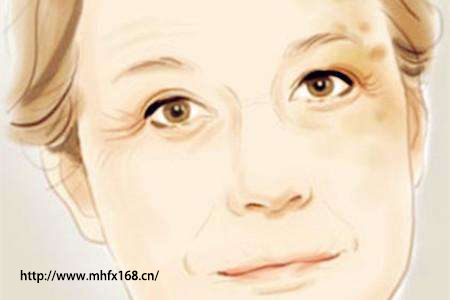 补硒可以抵抗鼻炎吗(抵抗补鼻炎硒可以长期吃吗)-硒宝网