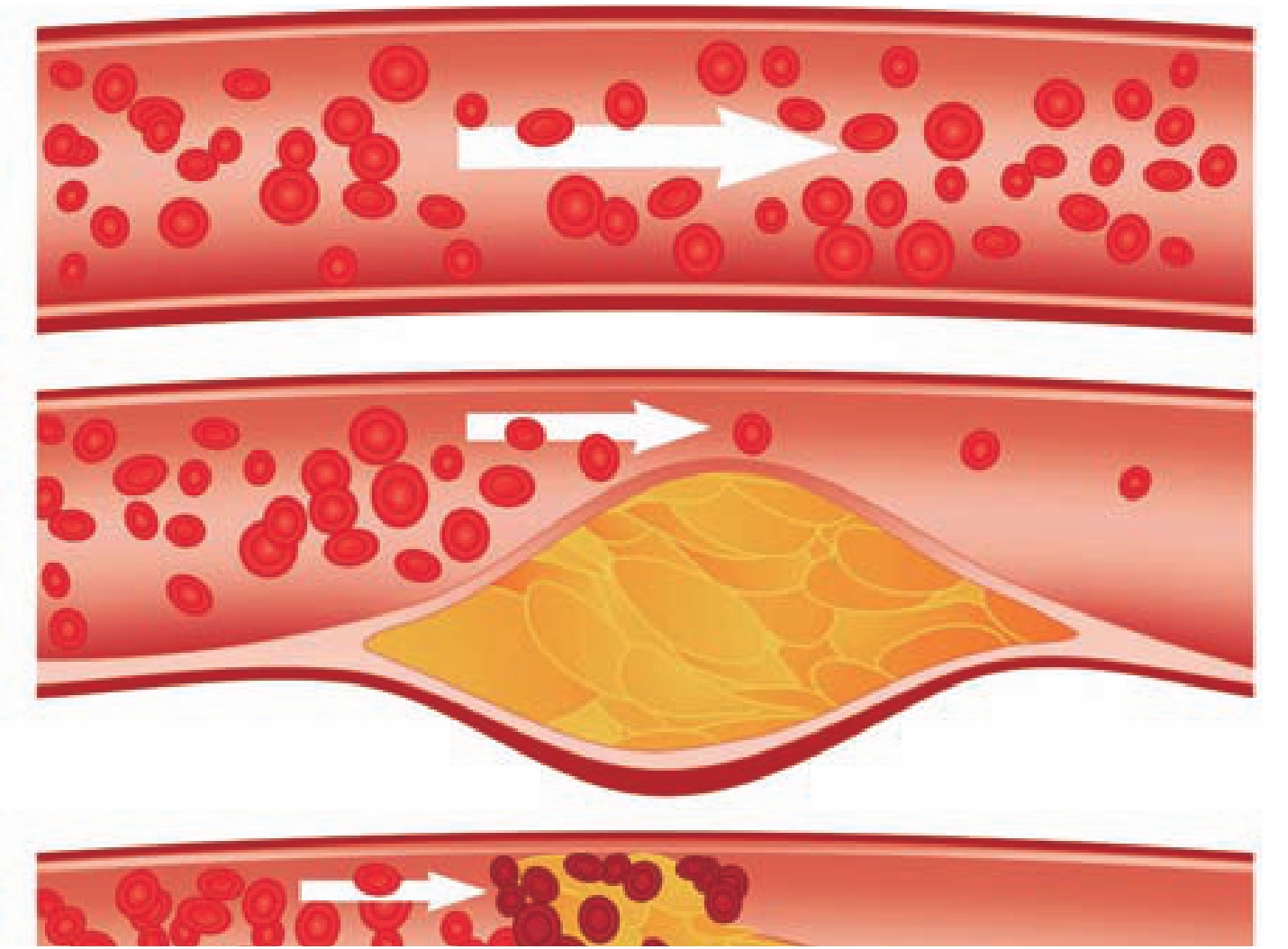 补铁的保健品(保健品补铁有用吗)-硒宝网