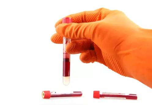 补铁的保健品(保健品补铁有用吗)-硒宝网