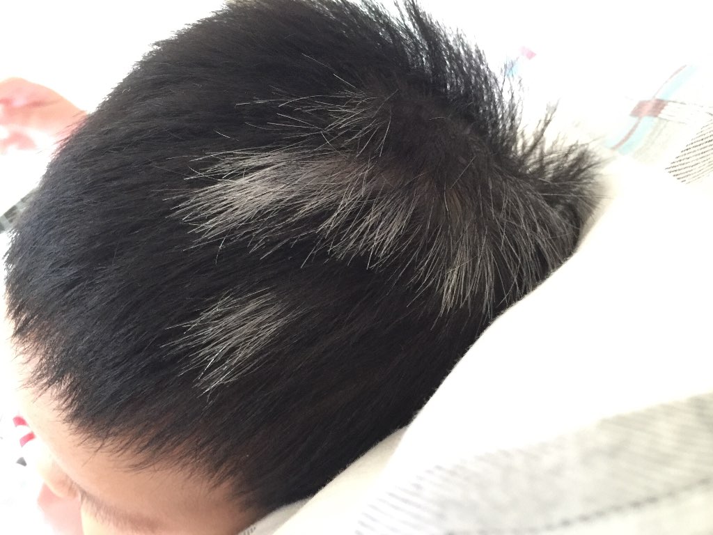 甲状腺哪不好要补硒(补甲状腺好硒要多长时间)-硒宝网