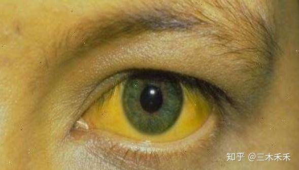 早期肺癌补硒多少克（肺癌补硒吃什么药）-硒宝网