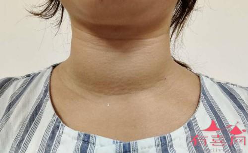 甲状腺激素低补硒吗(甲状腺激素低要补碘吗)-硒宝网