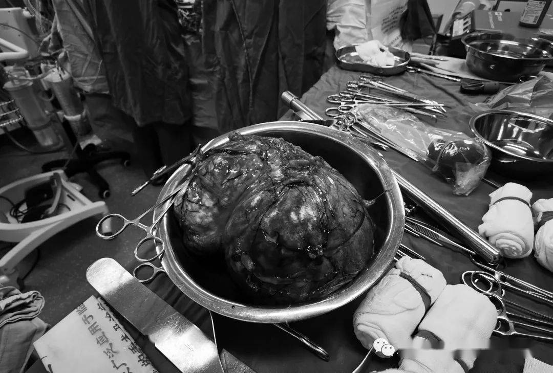 小孩能吃补硒补品吗(能补小孩补品吃硒元素吗)-硒宝网