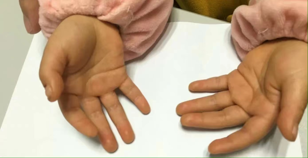 成人补硒吃什么食物（成人缺硒吃什么）-硒宝网