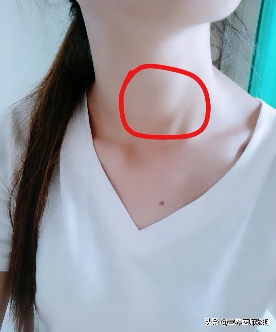 补硒后轻微甲亢好了(甲亢补硒补多久)-硒宝网