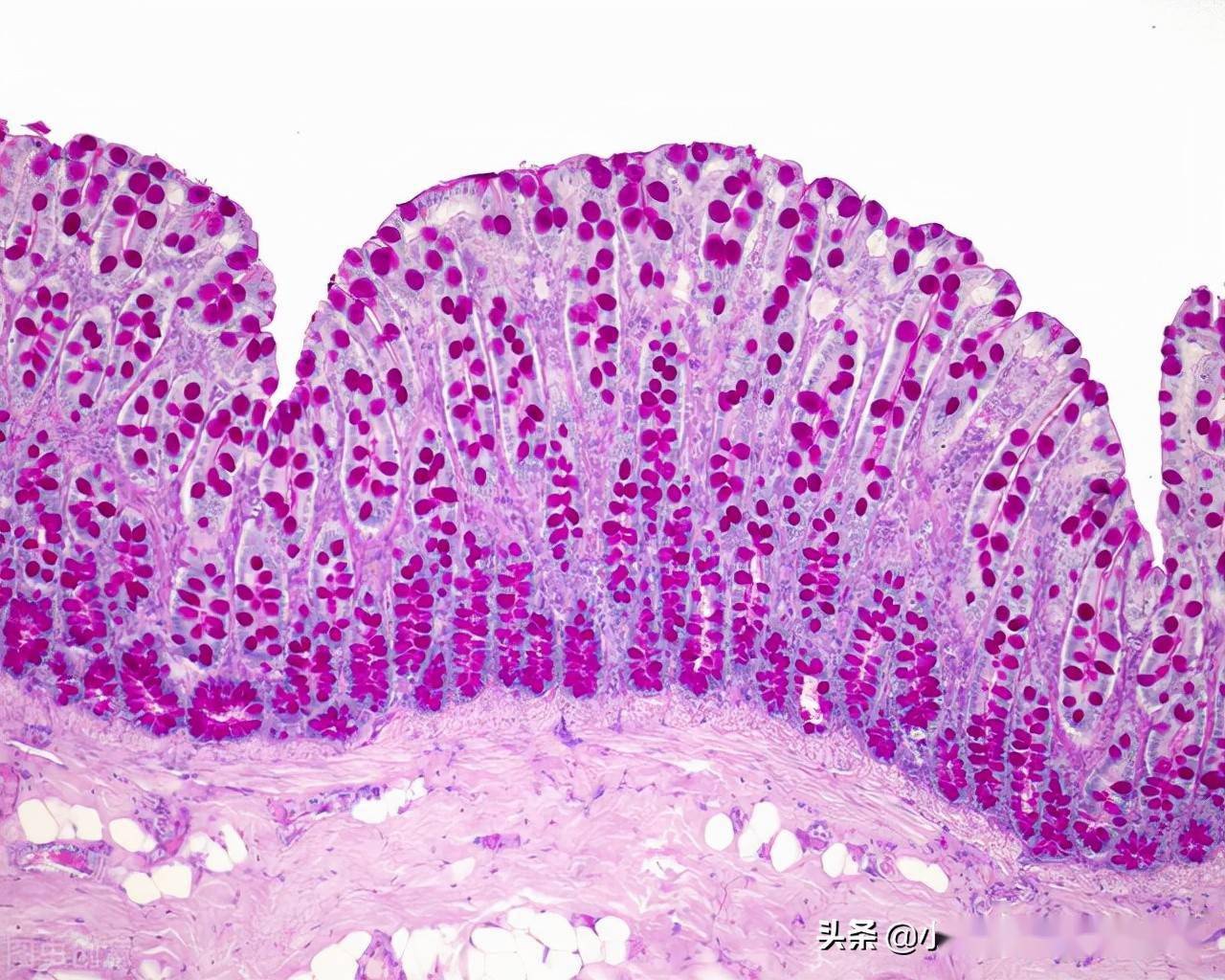 宝宝补钙会引起便秘吗(便秘补钙引起宝宝会便秘吗)-硒宝网