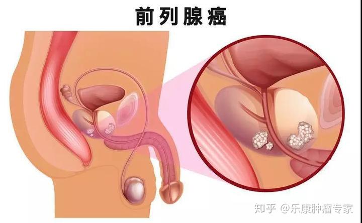 补硒锌能去hpv么（补锌硒能提高性功能吗）-硒宝网