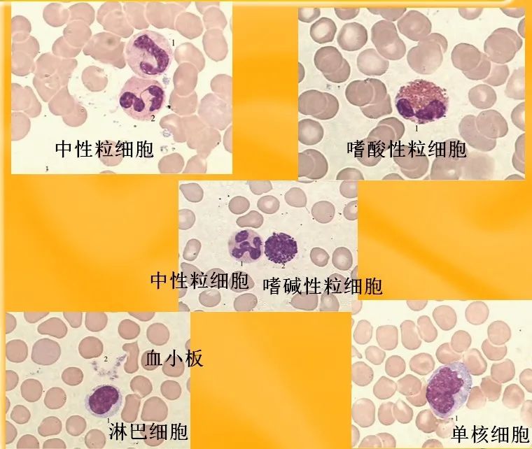 化疗期间补硒吃什么（化疗时补硒可以减轻副作用吗）-硒宝网