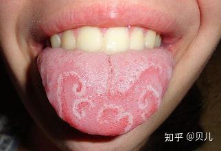 小孩如何补硒最有效(孩子补硒)-硒宝网