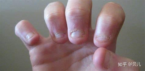 小孩如何补硒最有效(孩子补硒)-硒宝网