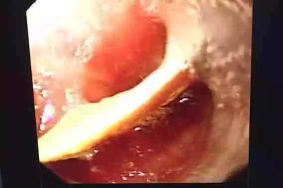 吃鸡蛋可以补钙吗(补钙吃鸡蛋有用吗)-硒宝网