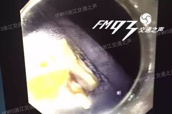 吃鸡蛋可以补钙吗(补钙吃鸡蛋有用吗)-硒宝网