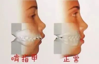 小孩咬指甲是缺什么微量元素(小孩啃指甲缺微量元素)-硒宝网