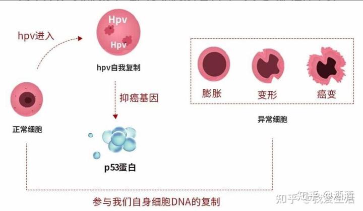 hpv16阳性补硒(hpv阳性吃补硒的有没有用)-硒宝网