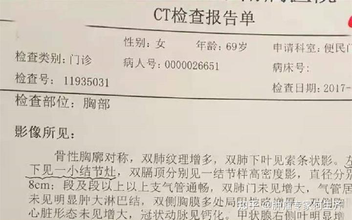 补硒能治疗肺部结节（肺结节补硒有用吗）-硒宝网