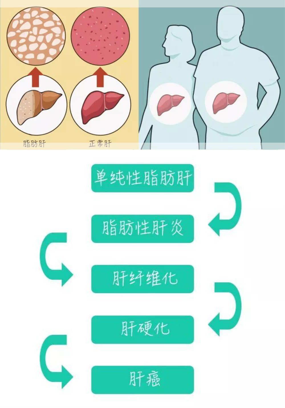 肝病病人吃什么补硒（病人补肝病吃硒片可以吗）-硒宝网