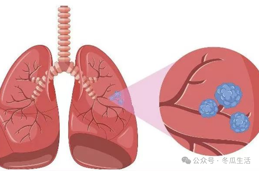 吃什么食物补硒最好(吃硒补什么)-硒宝网