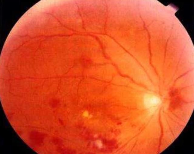 葡萄怎样补硒元素呢（补葡萄元素硒片的作用）-硒宝网