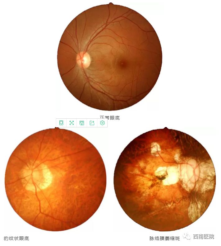 葡萄怎样补硒元素呢（补葡萄元素硒片的作用）-硒宝网