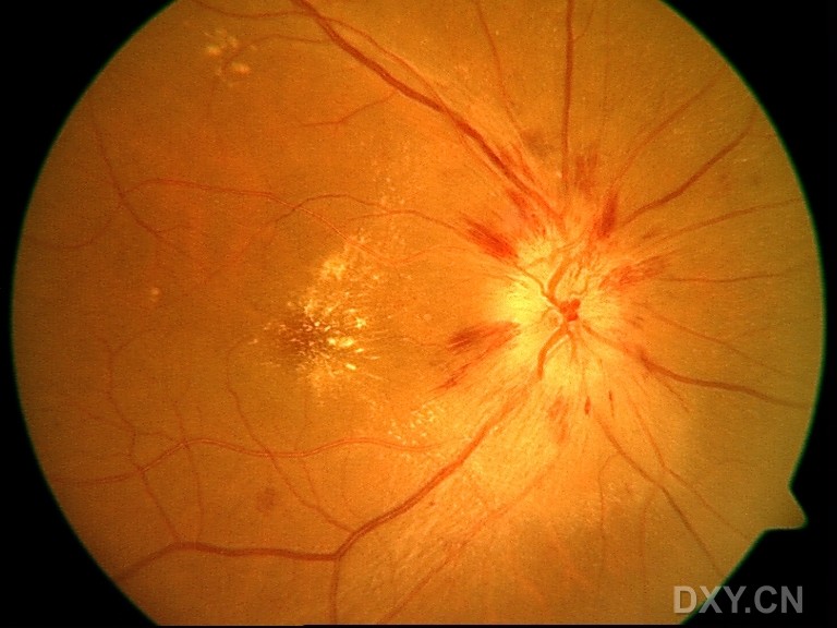 葡萄怎样补硒元素呢（补葡萄元素硒片的作用）-硒宝网