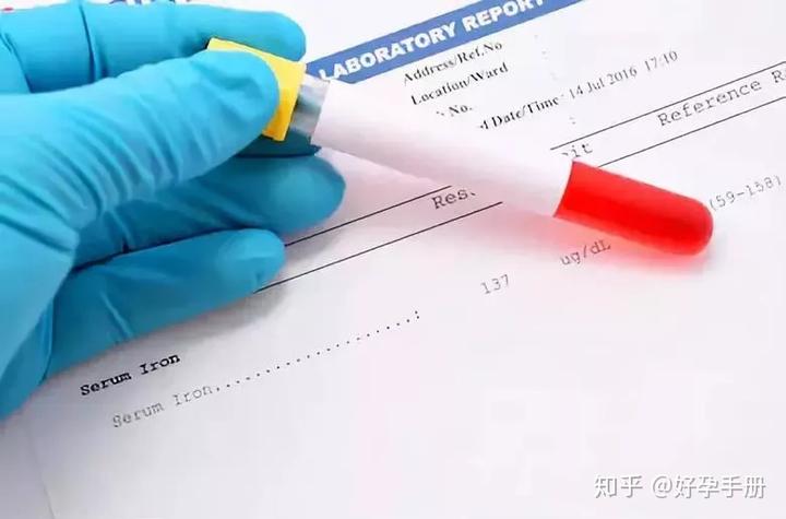 羊血补铁吗（羊血补血）-硒宝网