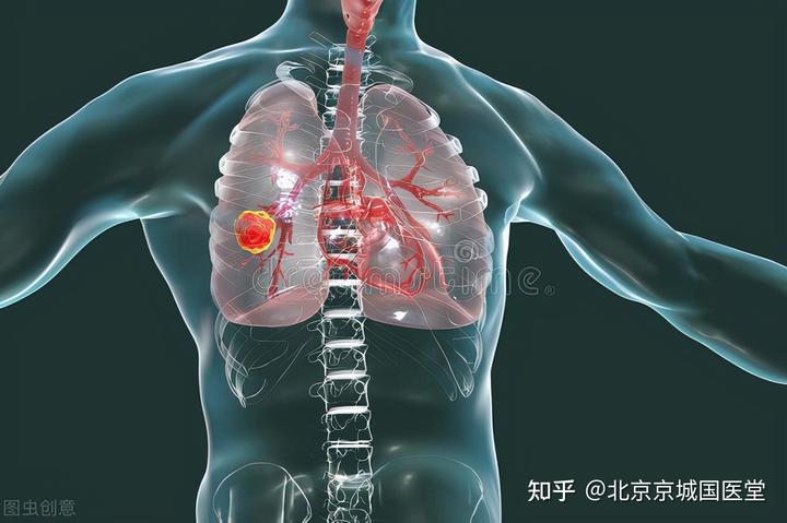 肺癌术后吃什么补硒(肺癌补硒痊愈)-硒宝网